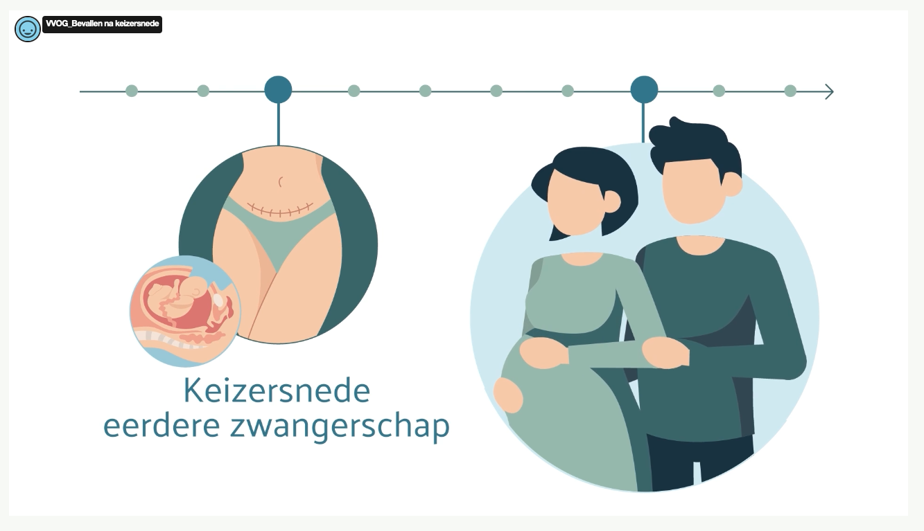 Animatievideo-bevallen-na-keizersnede-homepagina.png
